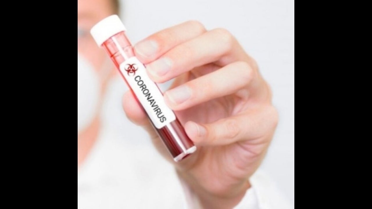 કોરોના વાયરસ બદલી રહ્યો તેના લક્ષણો,જાણો કોરોનામાં ક્યા 6 નવા લક્ષણો ઉમેરાયા 3 in coronavirusstrain