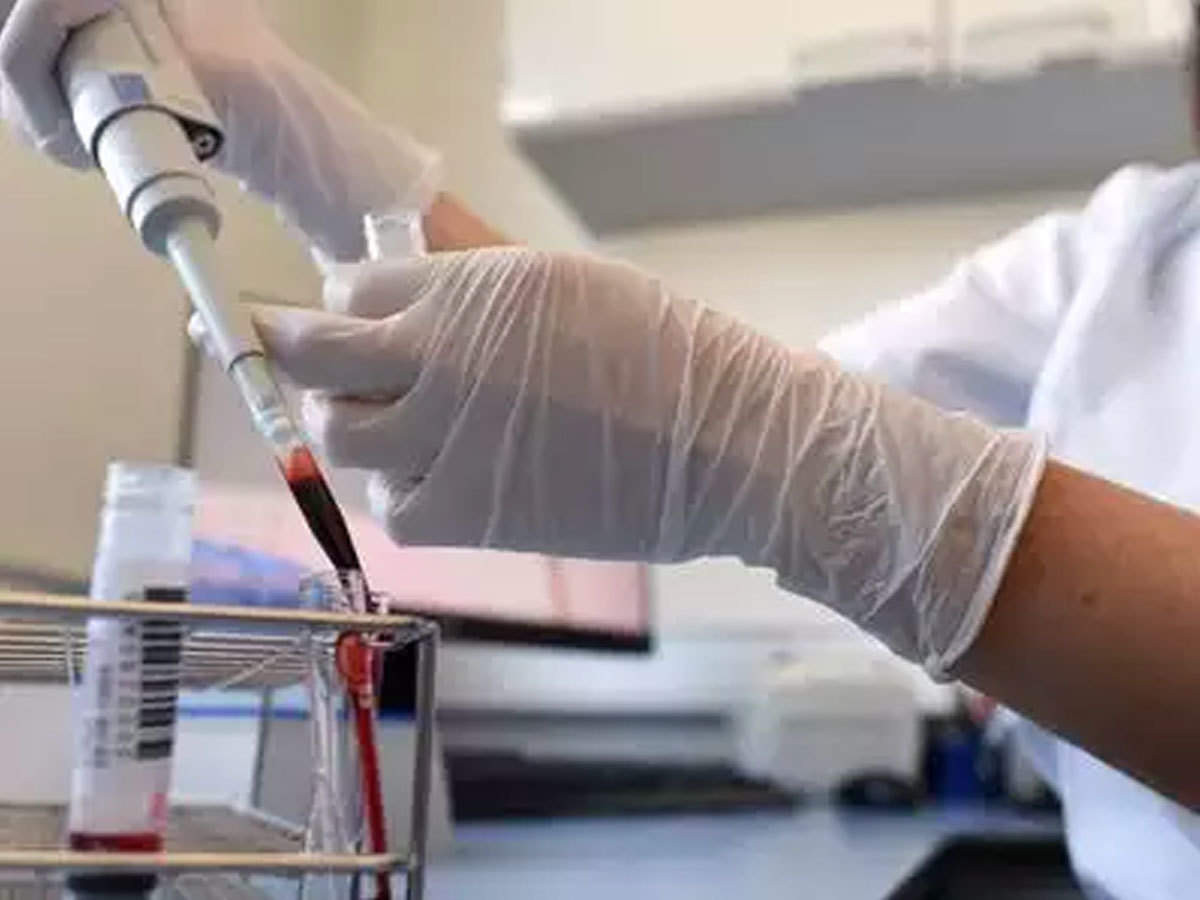 જાણો શું છે પ્લાઝમા થેરાપી અને કોરોના સામેની લડતમાં કેવી રીતે થઇ શકે છે ઉપયોગી 3 pic 1