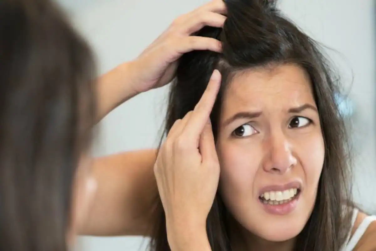 Premature white hair? So don't worry, here are his tips