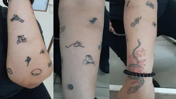 Tattoos can be done this way too! The girl angrily got 70 tattoos on her body
