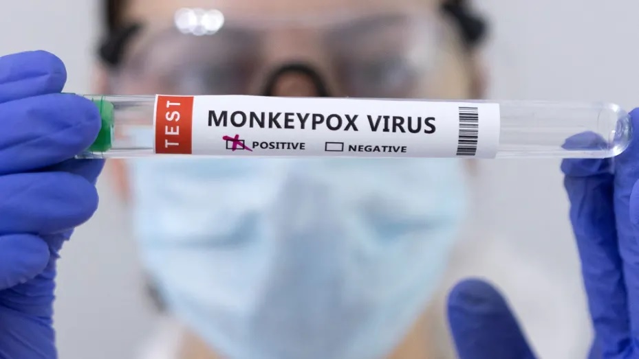 Big revelation about monkeypox! This thing also spreads the virus