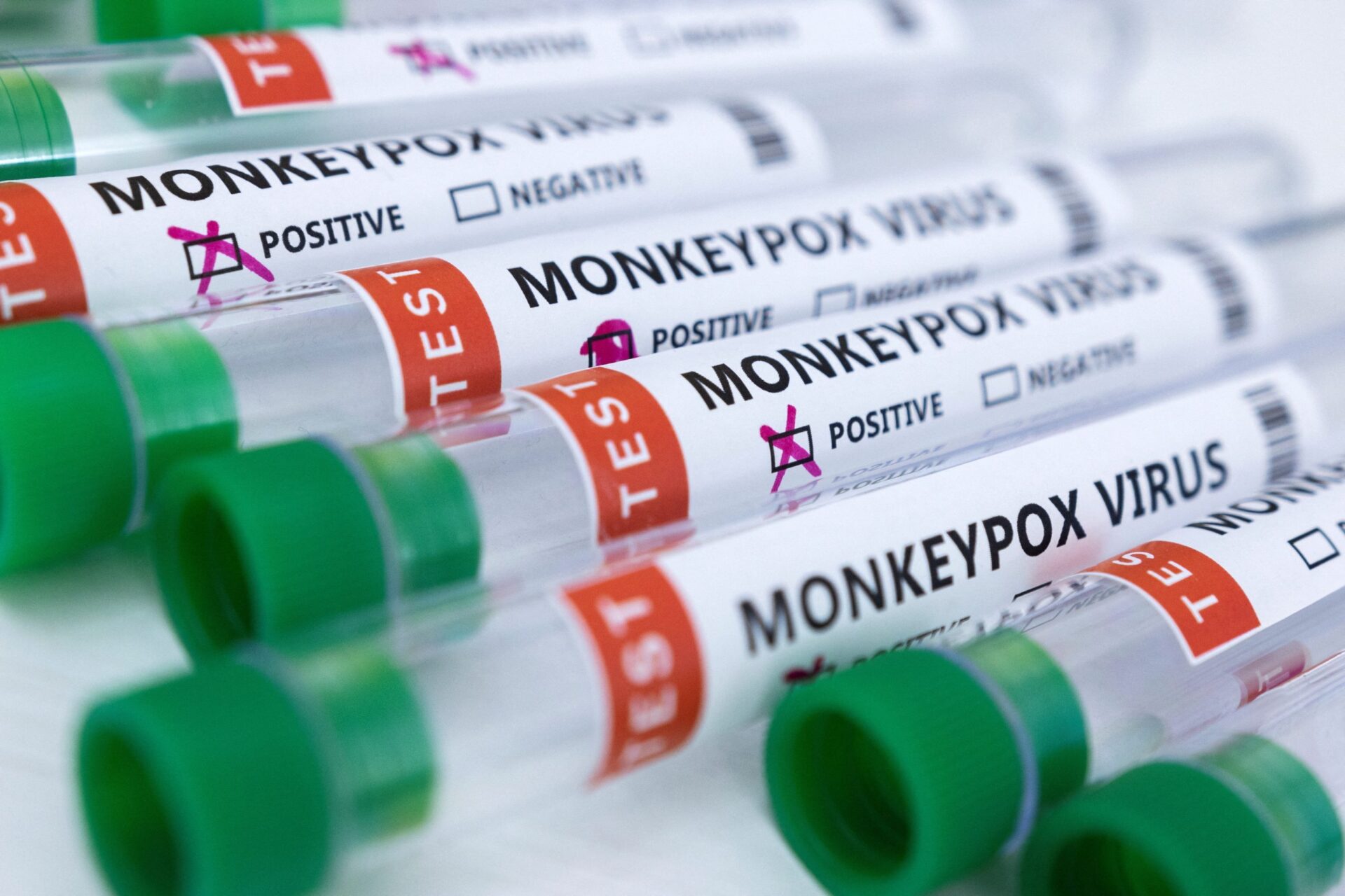 Big revelation about monkeypox! This thing also spreads the virus