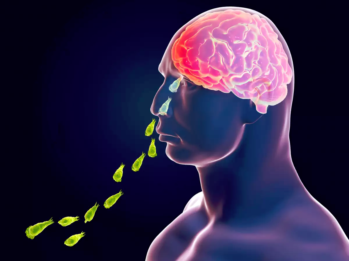 1688988055 158 નહાતી વખતે નાકમાંથી અમીબા ઘુસીને મગજ ખાઈ ગયું 15 વર્ષના