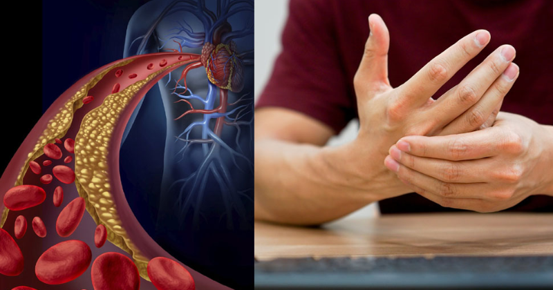 ખરાબ કોલેસ્ટ્રોલ અને ટ્રાન્સ ફેટના કારણે ભારતમાં દર વર્ષે 5 લાખથી વધુ લોકોના મોત થાય છે, સ્વાસ્થ્ય મંત્રીએ કહ્યું આ મોટી વાત 2 ખરાબ કોલેસ્ટ્રોલ અને ટ્રાન્સ ફેટના કારણે ભારતમાં દર વર્ષે 5 1