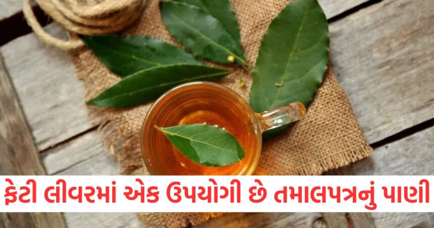 ફેટી લીવરમાં એક ઉપયોગી છે તમાલપત્રનું પાણી, આ સ્વાસ્થ્ય સંબંધિત સમસ્યાઓને પણ દૂર કરે છે, જાણો તેનો ઉપયોગ કરવાની સાચી રીત 1 GUJJU MEDIA FEATURE PHOTO 24