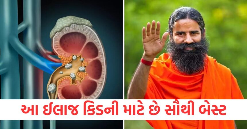 આ ઈલાજ કિડની માટે છે સૌથી બેસ્ટ, ગમે તેવી પથરી હોય કે બીજી કોઈ બીમારી થશે ફાયદો 1 GUJJU MEDIA FEATURE PHOTO 31