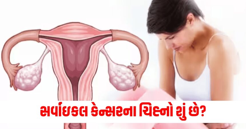 સર્વાઇકલ કેન્સરના ચિહ્નો શું છે? આ નાના લક્ષણો ખૂબ જ હાનિકારક સાબિત થઈ શકે છે 1 how to identify cervical cancer signs and symptoms of this disease