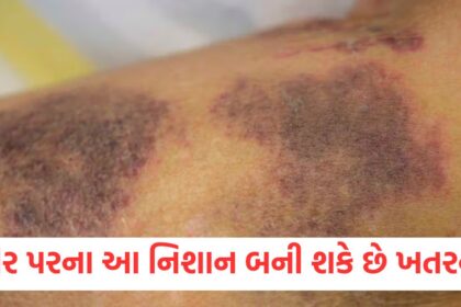 attention these marks visible on the body can be dangerous serious disease do not ignore them1