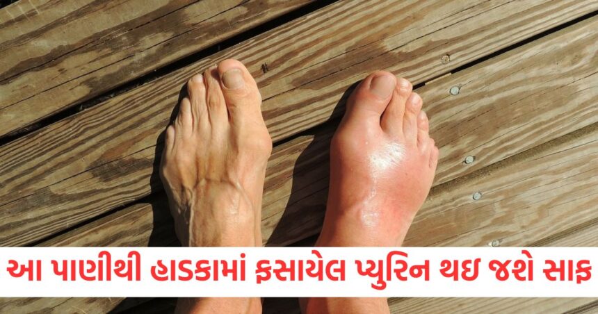 ગટગટાવી જાઓ આ વસ્તુનું પાણી હાડકામાં ફસાયેલ પ્યુરિન થઇ જશે સાફ, જાણો યુરિક એસિડમાં તેનો ઉપયોગ કેવી રીતે કરવો? 1 cinnamon water is beneficial in high uric acid knows how to make and when to drink14