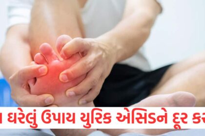 try these home remedies to control high uric acid1