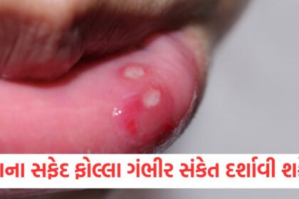 white blisters in the mouth can be a sign of these serious conditions1