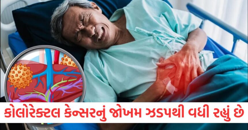 કોલોરેક્ટલ કેન્સરનું જોખમ ઝડપથી વધી રહ્યું છે, જો આ 5 લક્ષણો શરીરમાં દેખાય તો ભૂલથી પણ તેને અવગણશો નહીં 1 the risk of colorectal cancer is increasing rapidly if you see these 5 symptoms in body do not ignore