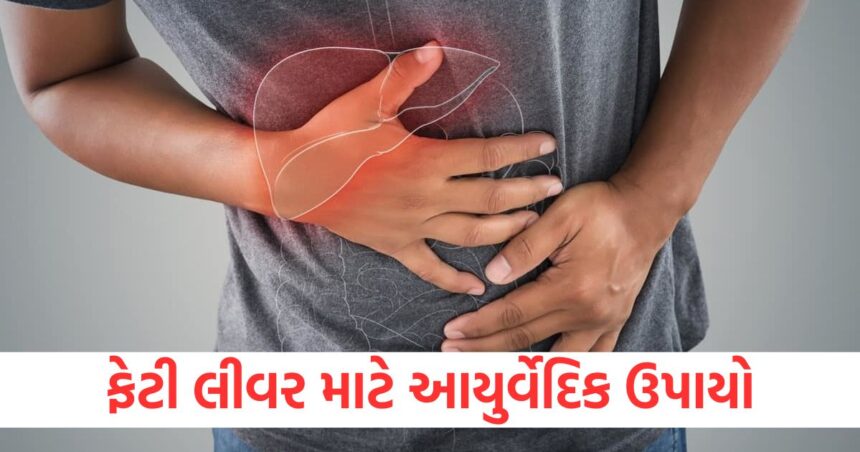 ફેટી લીવર માટે આયુર્વેદિક સારવાર શું છે? લીવર રોગથી છુટકારો મેળવવા માટે કઈ વસ્તુઓનું સેવન કરવું તે જાણો 1 What is the Ayurvedic treatment for fatty liver