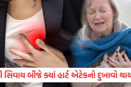 Where else in the body does heart attack pain occur besides the chest