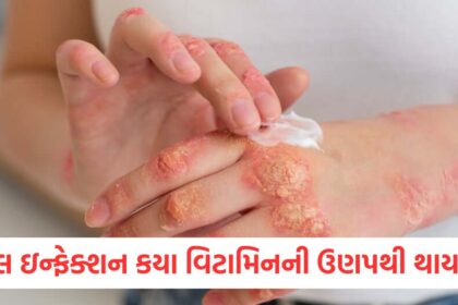Which vitamin deficiency causes fungal infection