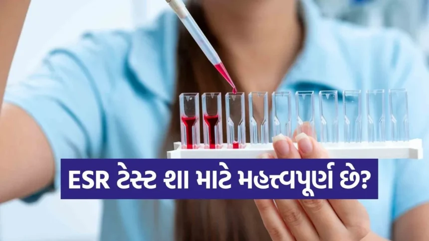 ESR ટેસ્ટ શું છે? જાણો આ સામાન્ય બ્લડ ટેસ્ટ વધે કે ઘટે તો કયા રોગનો સંકેત આપે છે! 1 ESR2.jpg.webp