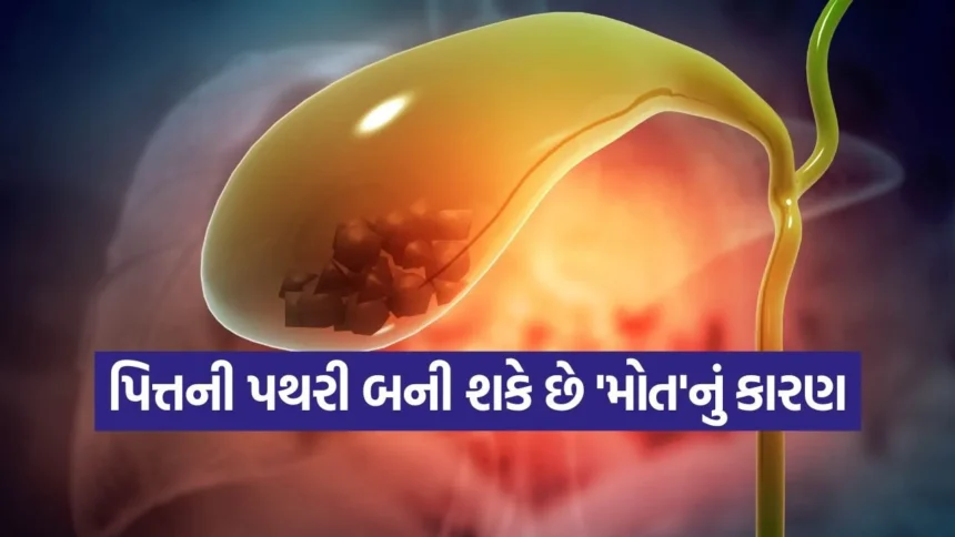 પિત્તની થેલીનો પથરી બની શકે છે ‘મોત’નું કારણ! જાણો ક્યારે છે આ રોગ અસાધ્ય 1 patheri.jpg.webp