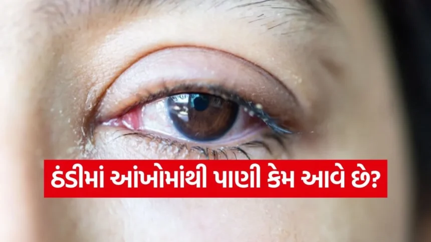 શિયાળામાં તમારી આંખોમાંથી પણ પાણી નીકળે છે? જાણો તેની પાછળના કારણો અને ઉપાય 1 1768604858 dharmishtha 1 37.jpg.webp