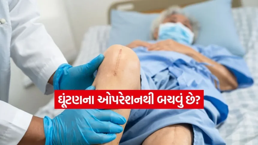 ઘૂંટણના ઓપરેશનથી બચવું છે? આજે જ બદલી નાખો તમારી આ 5 ખરાબ આદતો 1 INDIA 1 2026 01 23T234656.453.jpg.webp