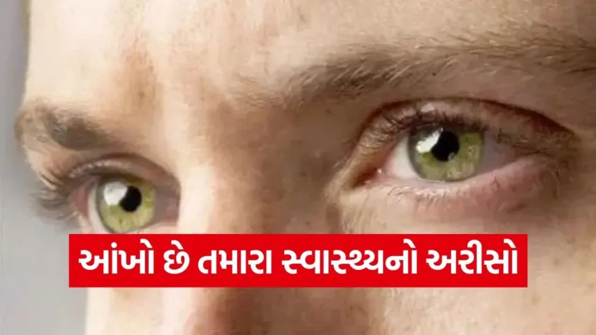 આંખો છે તમારા સ્વાસ્થ્યનો અરીસો: આ 7 સંકેતોને ક્યારેય નજરઅંદાજ ન કરો, હોઈ શકે છે ગંભીર બીમારી! 1 dharmishtha 1 37.jpg.webp