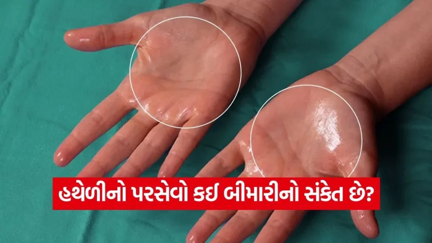 શું તમારા હાથ પણ વારંવાર પરસેવાથી ભીના થઈ જાય છે? જાણો આ પાછળનું તબીબી કારણ અને તેનાથી થતા જોખમો 1 1771495270 dharmishtha 1 19.jpg.webp