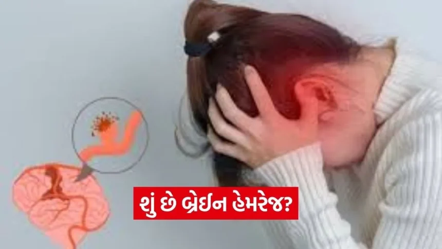 બ્રેઈન હેમરેજ કેમ થાય છે? જાણો તેના લક્ષણો, પ્રકાર અને બચાવ માટે નિષ્ણાતોની ખાસ સલાહ 1 dharmishtha 1 35.jpg.webp