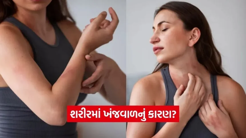 વિટામિન B12 અને A ની ઉણપથી પણ આવી શકે છે ખંજવાળ, જાણો આ સમસ્યાને કેવી રીતે દૂર કરવી 1 dharmishtha 1 7.jpg.webp