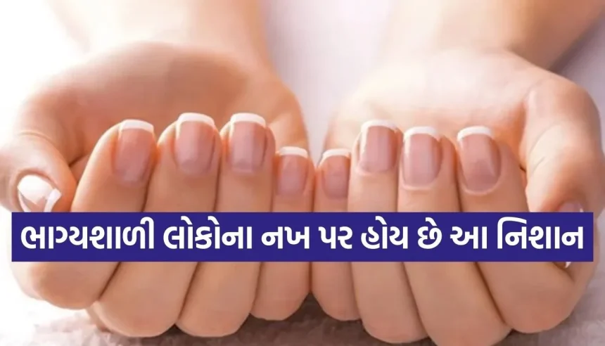 શું તમારા નખ પર પણ છે આવો ‘સફેદ ચાંદ’? જાણો શું કહે છે તમારું નસીબ અને સ્વાસ્થ્ય 1 Copy of Satya web temp 2026 03 11T143903.190.jpg.webp