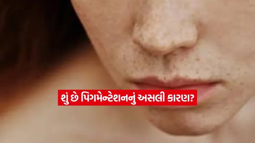 કેમ થાય છે ચહેરા પર કાળા ડાઘ અને ઝાઈઓ? એક્સપર્ટ પાસેથી જાણો તેનાથી બચવાની સાચી રીત 1 pigmentent.jpg.webp