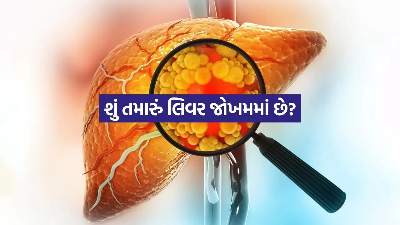 સાવધાન! ફેટી લિવરને સામાન્ય ન ગણતા, જાણો ક્યારે આ બીમારી જીવલેણ બની શકે છે