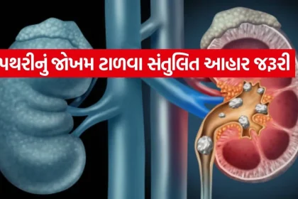 Kidney stone 3004.jpg.webp