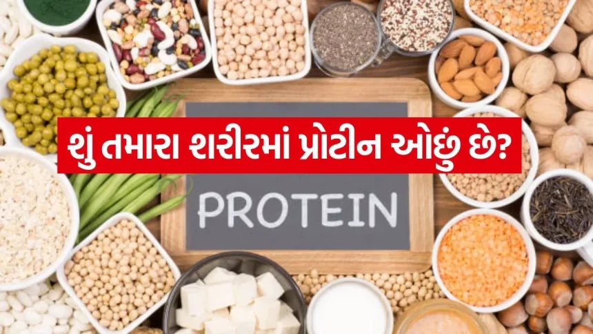 વાળ ખરવા અને ત્વચાની નિસ્તેજતા પાછળ હોઈ શકે છે પ્રોટીનની ઉણપ, જાણો બચવાના સરળ ઉપાય. 1 Protein 3004.jpg.webp