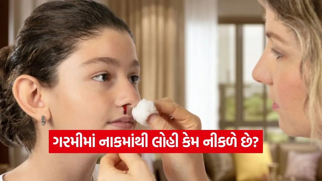 ઉનાળામાં અચાનક નાકમાંથી લોહી નીકળે તો ગભરાશો નહીં, તરત જ કરો આ 5 ઘરગથ્થુ ઉપાયો
