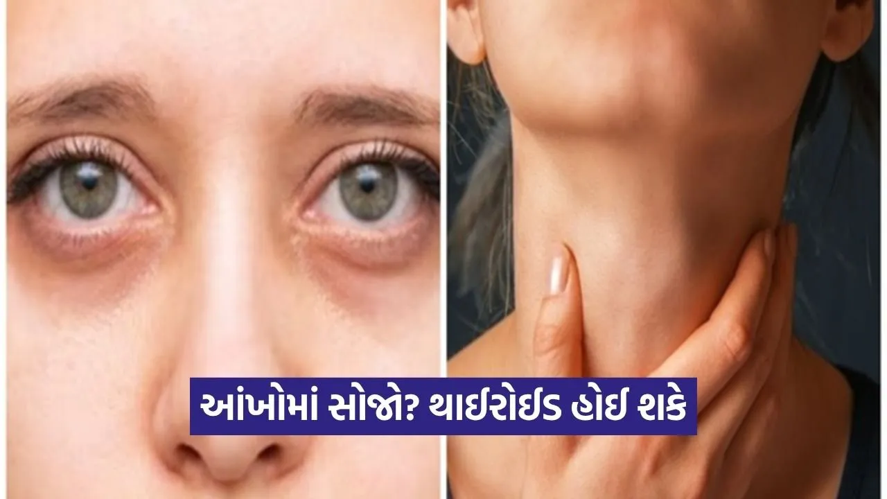 શું તમારી આંખો વારંવાર સૂજી જાય છે? સાવધાન, આ હોઈ શકે છે થાઈરોઈડનો સૌથી પહેલો સંકેત!