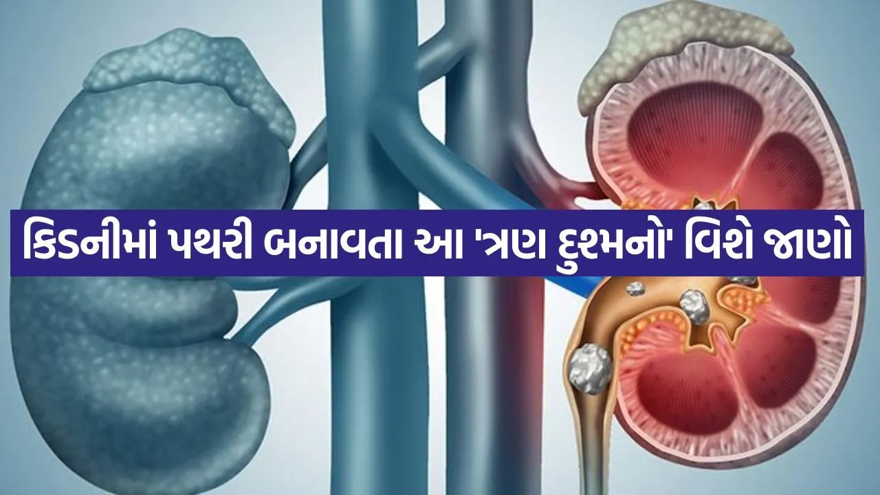કિડની સ્ટોનનું જોખમ ઘટાડવા માટે શું ખાવું અને શું ટાળવું?