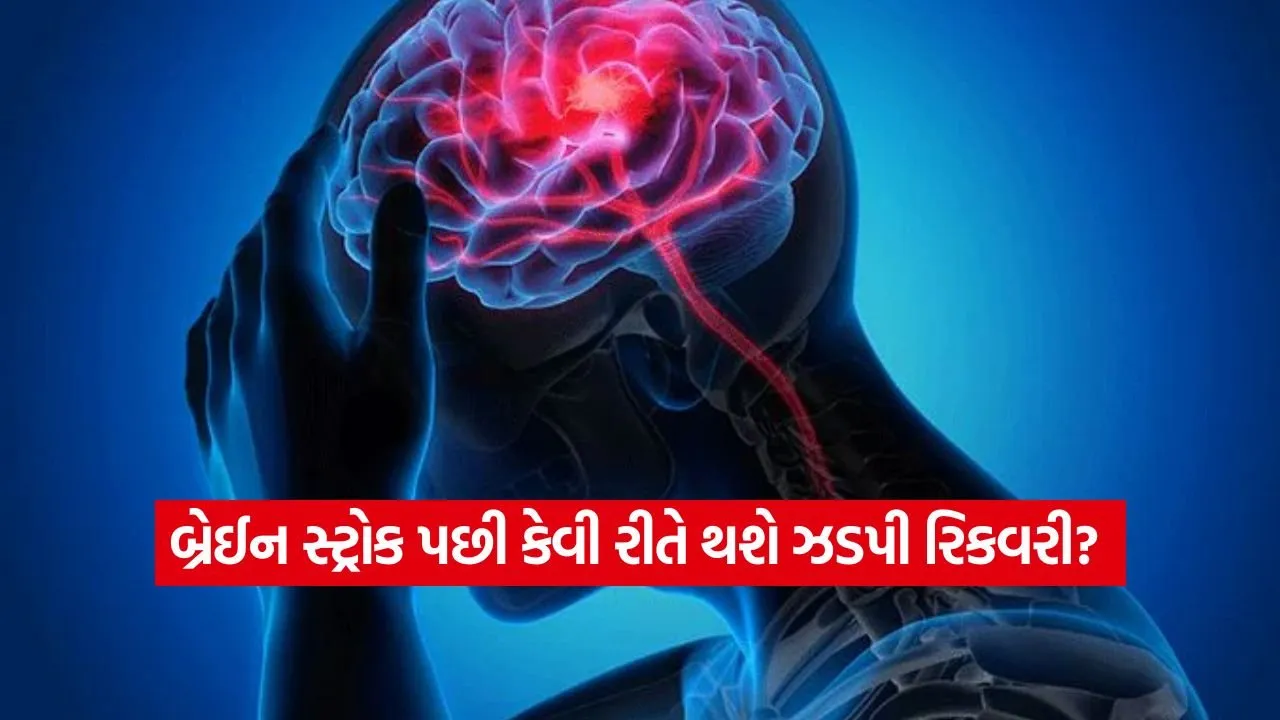 બ્રેન સ્ટ્રોક પછી કેવી રીતે મેળવવી ઝડપી રિકવરી? જાણો ડોક્ટરની ખાસ ટિપ્સ અને સાવચેતીઓ