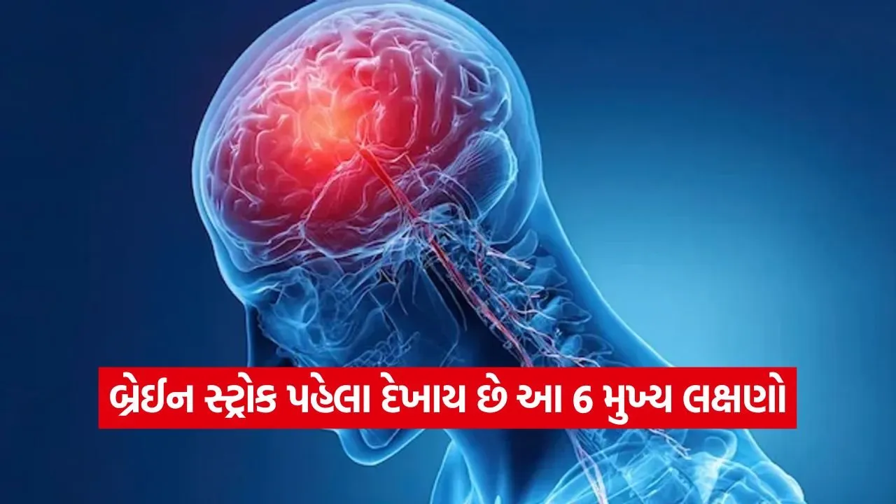મગજમાં લોહી ગંઠાઈ જવાના આ 6 સંકેતોને ક્યારેય ન અવગણતા; સ્ટ્રોક આવતા પહેલા શરીર આપે છે આ ચેતવણી