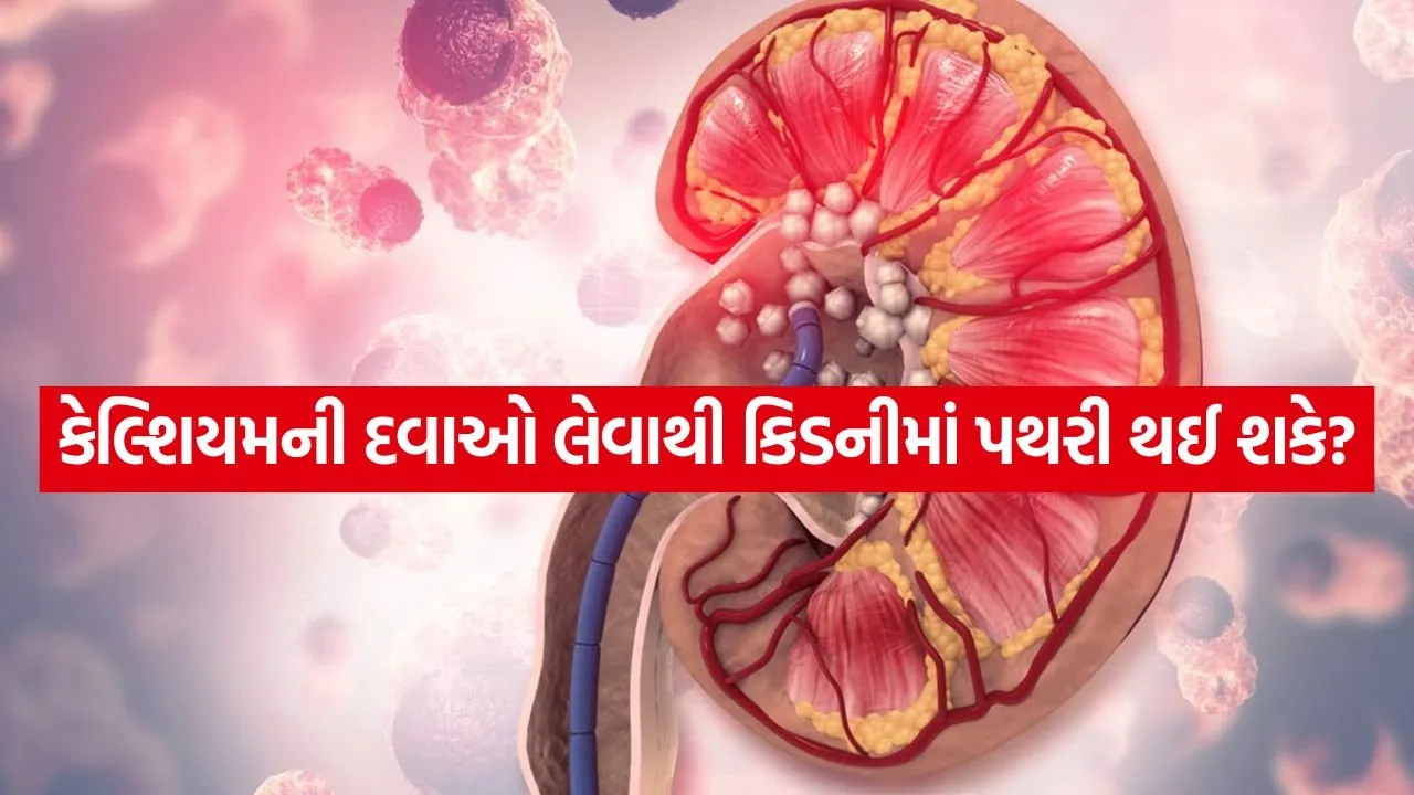 Kidney stone 1907.jpg.webp