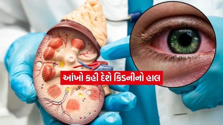 કિડની ખરાબ થતાં જ આંખો આપશે આ સંકેત, આ 5 લક્ષણોને ક્યારેય ન કરો ઇગ્નોર! 1 eyes.jpg.webp