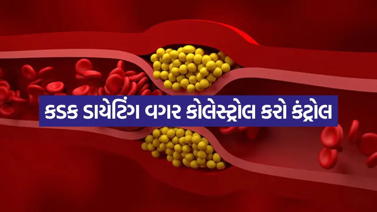 High Cholesterol Control 0208.jpg.webp