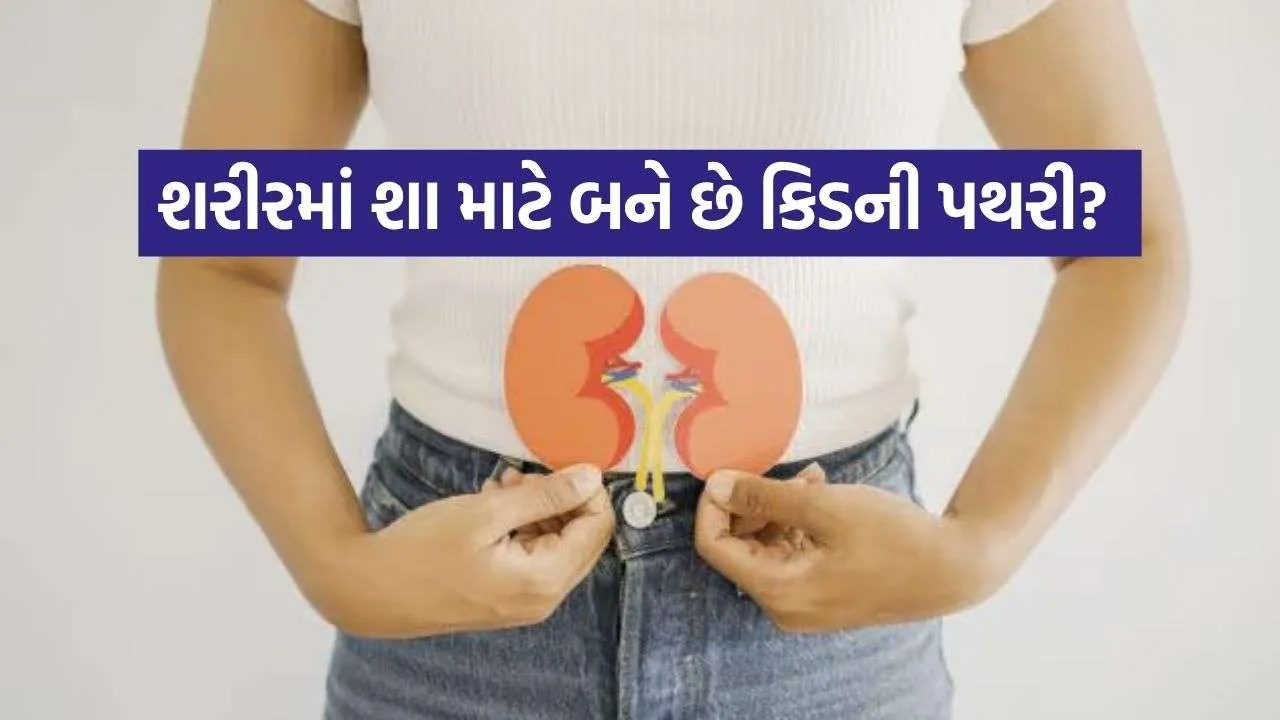 Kidney stone 2908.jpg.webp