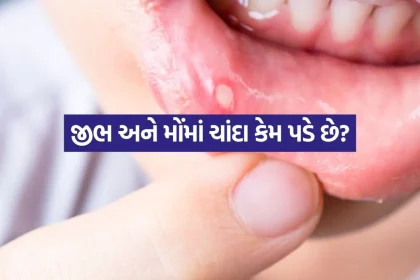 Mouth Ulcers 0608.jpg.webp