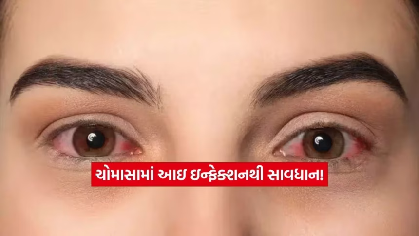 આંખોમાં બળતરા અને સોજો: ચોમાસામાં આ લક્ષણોને સામાન્ય ગણવાની ભૂલ ન કરતા! 1 eyes.jpg.avif