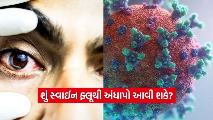 સ્વાઈન ફ્લૂ (H1N1) માં માત્ર ગળું કે ફેફસાં નહીં, આંખો પણ થઈ શકે છે પ્રભાવિત: જાણો આ 7 મહત્વપૂર્ણ ચેતવણીજનક લક્ષણો 1 iNDIA 2026 08 28T111806.247.jpg.webp