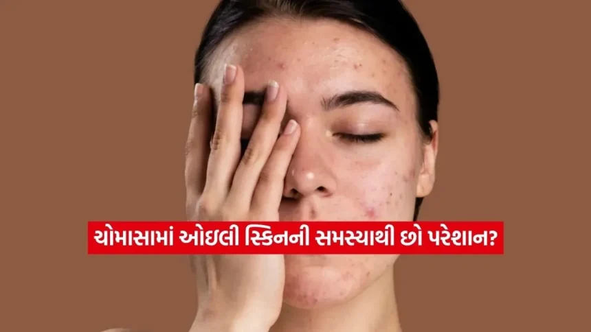 ચોમાસામાં ત્વચા કેમ થઈ જાય છે વધુ પડતી ઓઇલી? શું વારંવાર ચહેરો ધોવાથી મળશે રાહત? જાણી લો ડર્મેટોલોજિસ્ટની સાચી સલાહ! 1 skin.jpg.webp