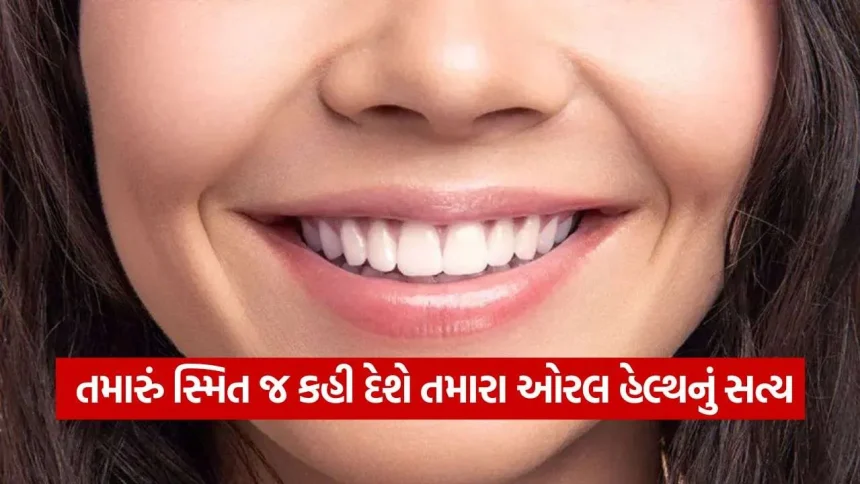માત્ર પરફેક્ટ સફેદ દાંત જ નહીં, સ્વસ્થ પેઢા અને કુદરતી સ્મિત છે ખરી સુંદરતા 1 Smile 1209.jpg.webp