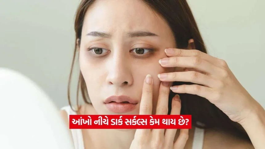 આંખો નીચેના ડાર્ક સર્કલ્સથી પરેશાન છો? જાણો મુખ્ય કારણો અને ઘરેલુ ઉપાય! 1 dark cricle2.jpg.webp