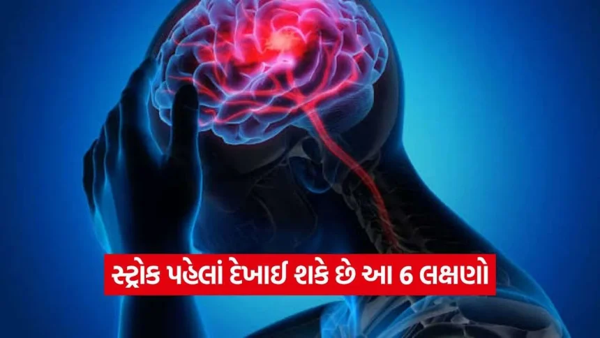 Stroke Symptoms12.jpg.webp