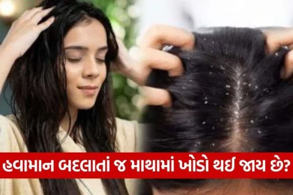 dandruff 1410.jpg.webp