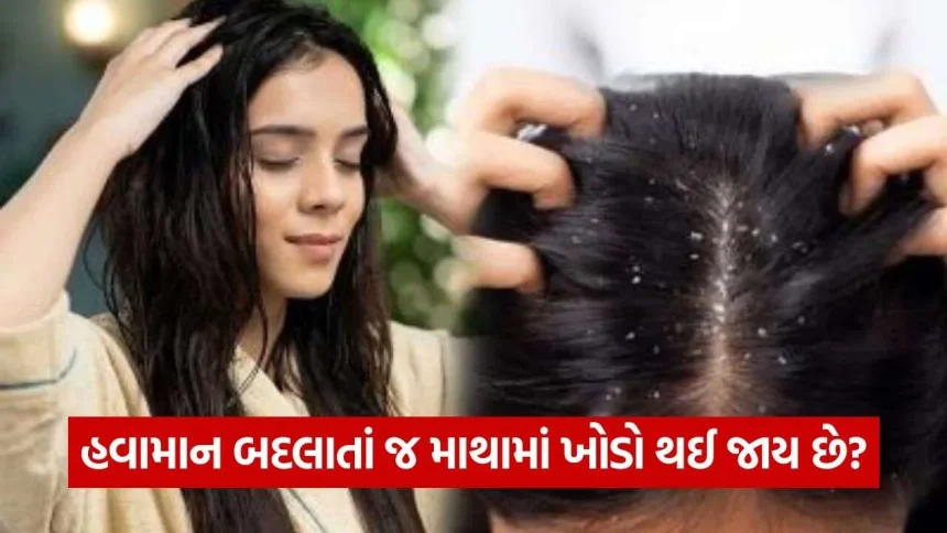 dandruff 1410.jpg.webp